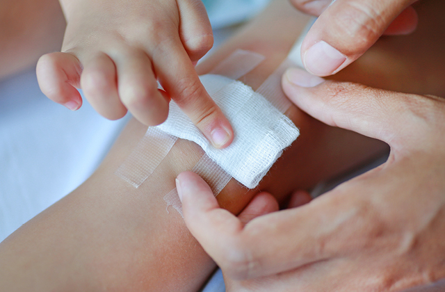Mother applying bandage to child's knee. For best results, spray Colloidal Silver on the affected area, allow to dry for 15 minutes and then apply Colloidal Silver Cream. 